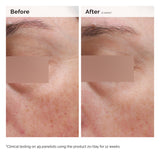 Niacinamide 5% Face And Body Emulsion