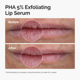 PHA 5% Exfoliating Lip Serum