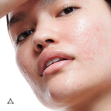 Molecular Saviour Probiotics Treatment Mist