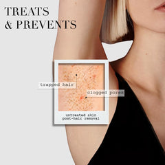 Free The Ingrown Bar With Any Kaia Naturals Purchase