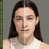 Redness Rescue Cream