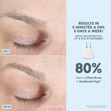 NuFACE® Trinity+ PRO - Complete Set