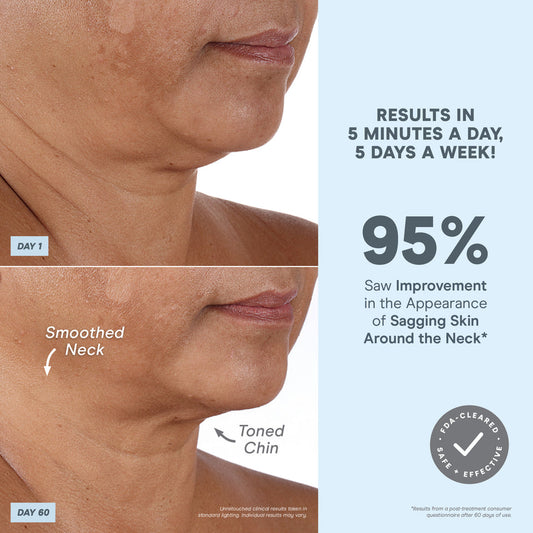 NuFACE® MINI+ Starter Kit - Smart Petite Facial Toning Kit