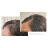 Virtue® Flourish® Hair Rejuvenation Treatment Set for Thinning Hair at Socialite Beauty Canada