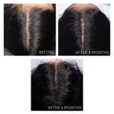 Virtue® Flourish® Hair Growth Density Booster at Socialite Beauty Canada