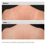 Salicylic Acid 0.5% Body Serum