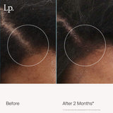 Scalp Care Revitalizing Treatment