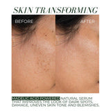 Clear + Bright Mandelic Drops