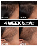 Sponsored - Hair Density Scalp Treatment