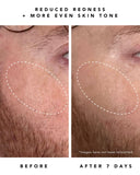 Nova 15% Vitamin C + Tumeric Brightening Serum